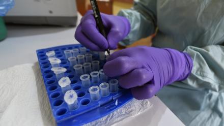 Au laboratoire de l’Institut de recherche et de lutte contre la fièvre de Lassa, à l’hôpital universitaire spécialisé d’Irrua, à Irrua, dans l’État d’Edo, au centre-ouest du Nigeria, le 6 mars 2018
