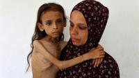 Photo prise le 2 août 2025 d'une fillette palestinienne de neuf ans souffrant de malnutrition, Mariam Dawwas, portée par sa mère, Modallala, dans le quartier de Rimal dans la ville de Gaza.