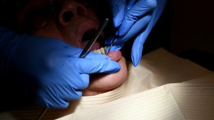 Dans un cabinet dentaire à Washington le 28 octobre 2021
