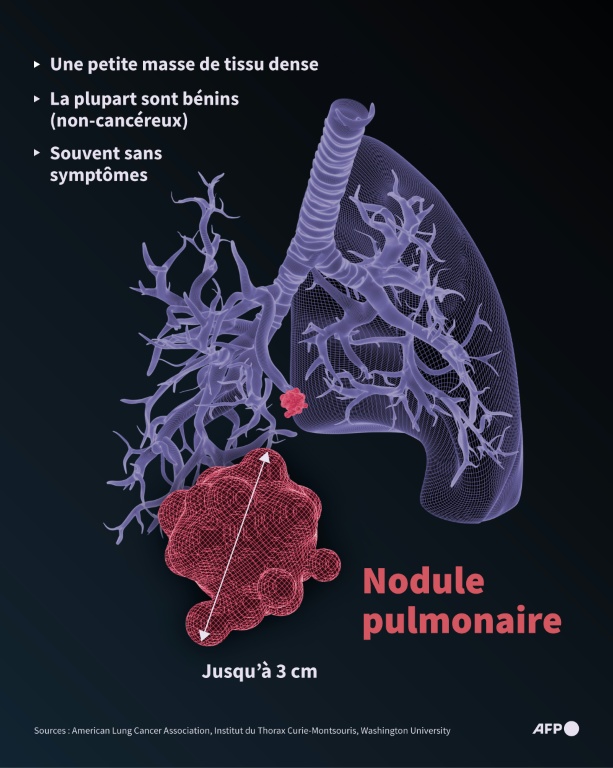 Nodule pulmonaire