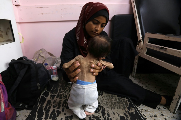 Yasmine, une mère palestinienne de 22 ans, tient dans ses bras sa fille Teen, âgée de deux mois et souffrant de malnutrition, alors qu'elles attendent d'être soignées à l'hôpital Nasser de Khan Younes, dans le sud de la bande de Gaza, le 24 juillet 2025
